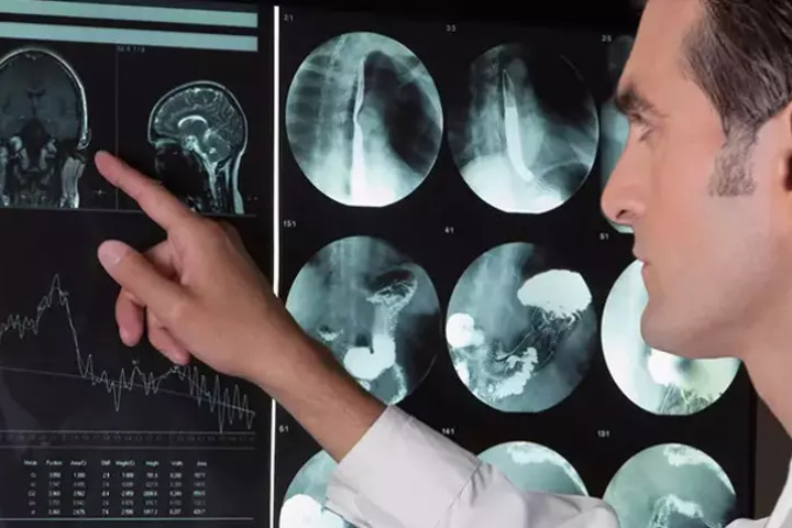 Консультация нейрохирурга (по записи)