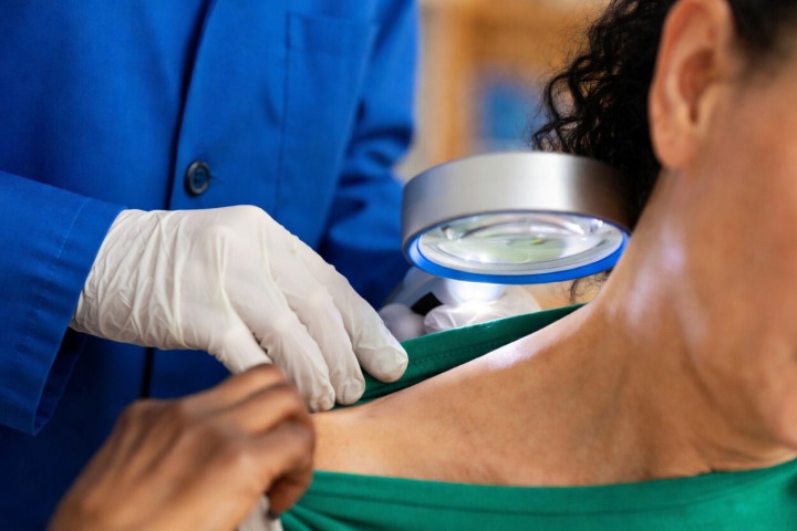 Консультация дерматолога